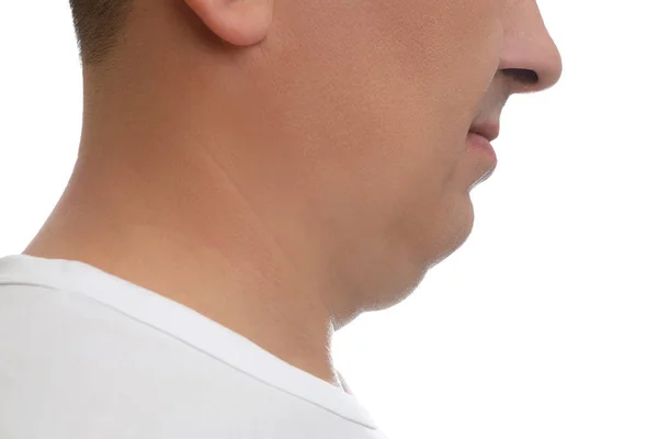 Mature man with double chin on white background, closeup — Stock Photo, Image