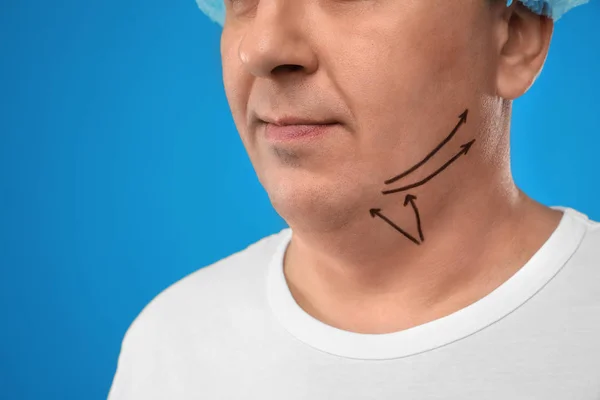 Mature man with marks on face against blue background, closeup. — Stock Photo, Image