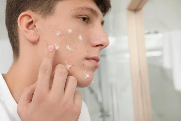 Teen guy with acne problem applying cream in bathroom, closeup — Stock Photo, Image