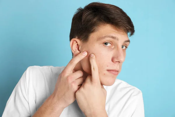 Teen guy with acne problem squeezing pimple on light blue backgr — Stock Photo, Image