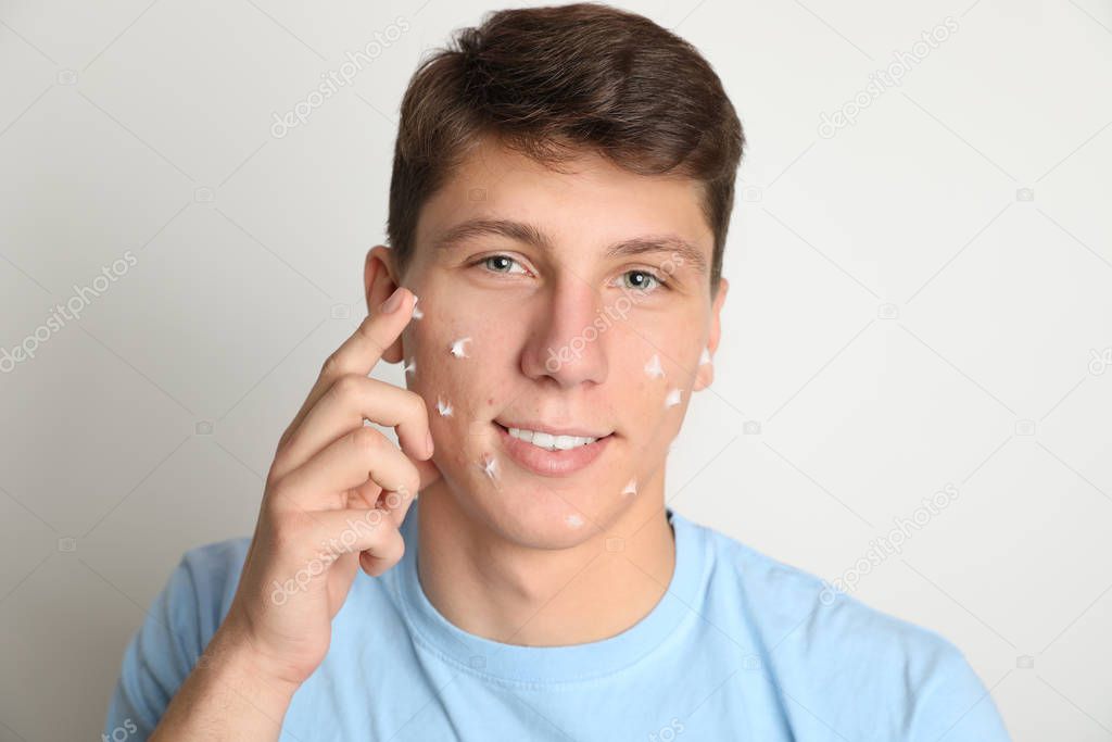 Teen guy with acne problem applying cream on light background