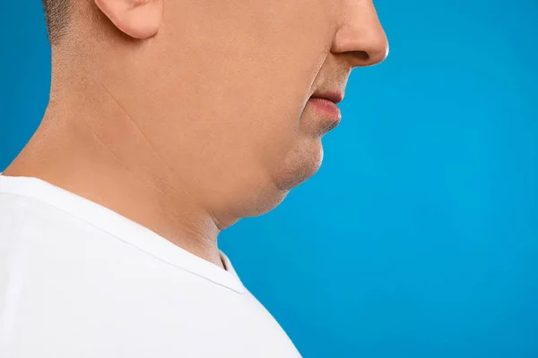 Mature man with double chin on blue background, closeup — Stock Photo, Image