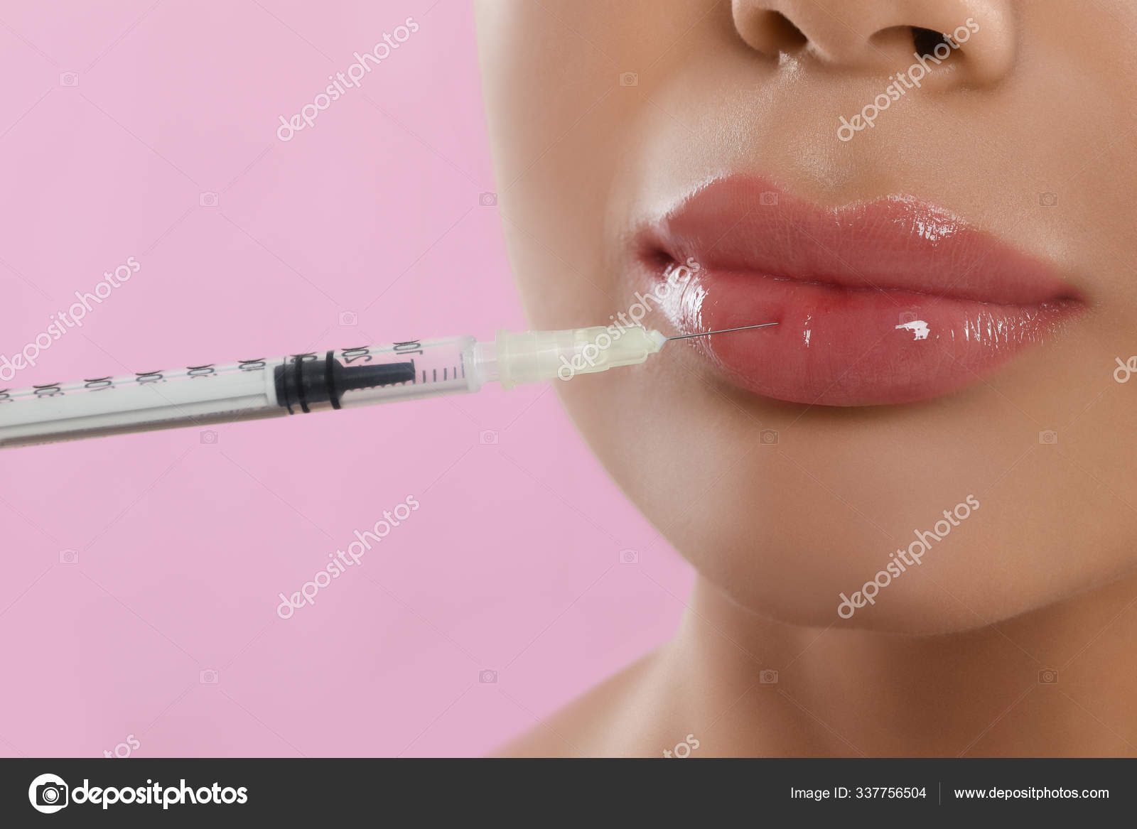 Young Woman Getting Lips Injection Pink Background Closeup Stock Photo