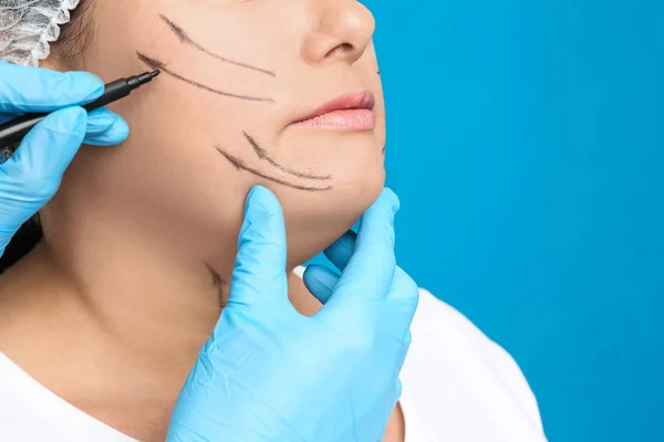Lekarz rysujący ślady na twarzy kobiety do operacji chirurgii plastycznej — Zdjęcie stockowe