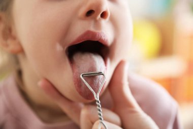 Konuşma terapisti, küçük Gi ile seansta logopedik sonda kullanıyor.