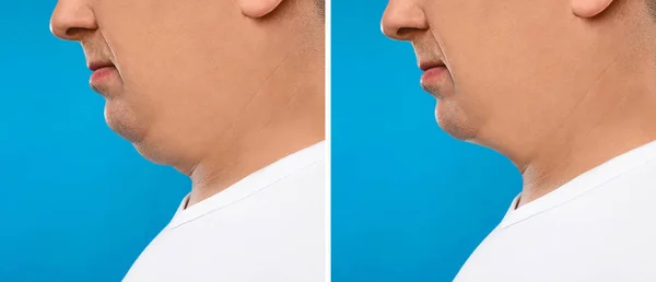 Mature man with double chin on blue background, closeup — Stock Photo, Image