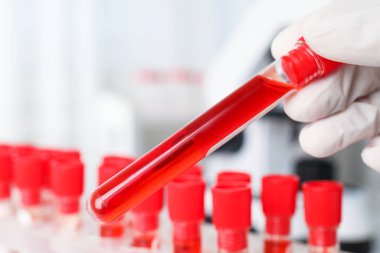 Laboratuvarda üzerinde kan örneği olan test tüpünü tutan bilim adamı, yakın plan. Virüs araştırması