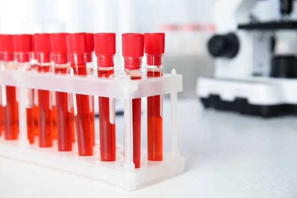 Laboratuvarda Üzerinde Kan Örnekleri Olan Test Tüpleri Yakın Plan Virüs — Stok fotoğraf