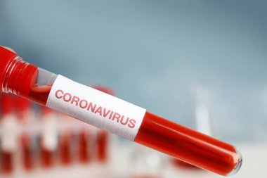 Kan örneğiyle test tüpü ve laboratuarda Corona Virüsü etiketi, yakın plan.