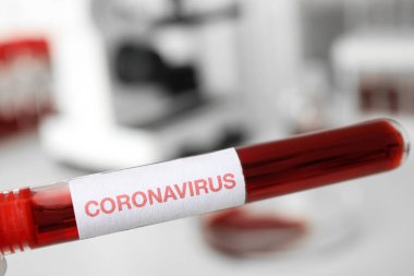 Kan örneğiyle test tüpü ve laboratuarda Corona Virüsü etiketi, yakın plan.