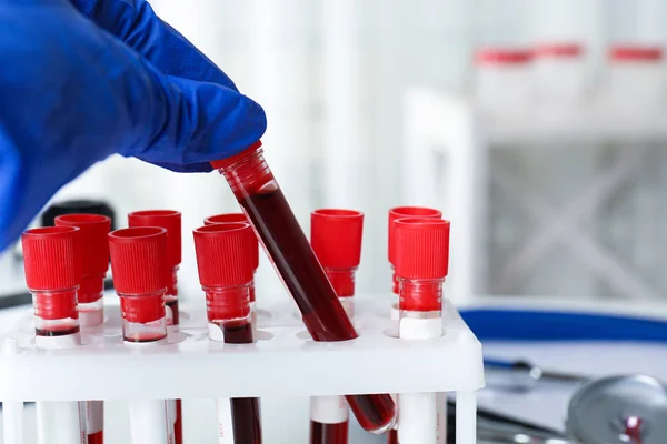 Científico Tomando Probeta Con Muestra Sangre Estante Laboratorio Primer Plano — Foto de Stock