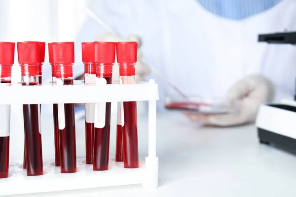 Tubos Ensayo Con Muestras Sangre Mesa Del Laboratorio Investigación Del — Foto de Stock