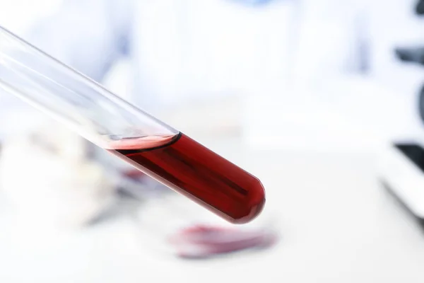 Тестовая Трубка Образцом Крови Размытом Фоне Крупным Планом Вирусные Исследования — стоковое фото