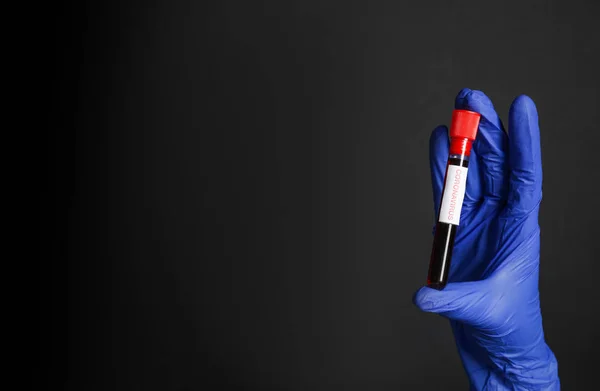 Wetenschapper Houdt Reageerbuis Met Bloedmonster Label Corona Virus Zwarte Achtergrond — Stockfoto