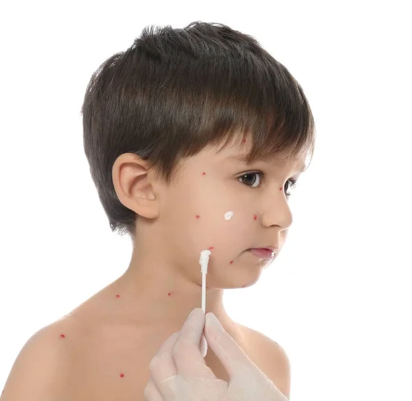 Γιατρός Εφαρμογή Κρέμα Στο Δέρμα Του Μικρού Αγοριού Ανεμοβλογιά Λευκό — Φωτογραφία Αρχείου