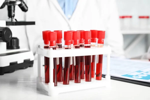 Testovací Zkumavky Vzorky Krve Stole Laboratoři Virus Research — Stock fotografie