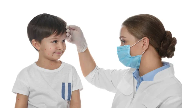 Lekarz Badający Małego Chłopca Ospą Wietrzną Białym Tle Wirus Półpaśca — Zdjęcie stockowe