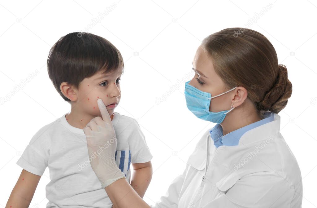 Doctor examining little boy with chickenpox on white background. Varicella zoster virus