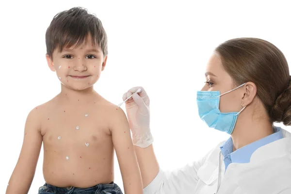 白い背景に水痘で小さな男の子の皮膚にクリームを適用する医師 ワリセラゾスターウイルス — ストック写真