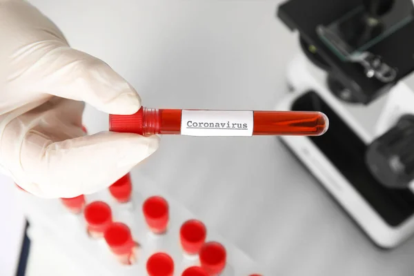 Ilmuwan Memegang Tabung Uji Dengan Sampel Darah Dan Label Corona — Stok Foto