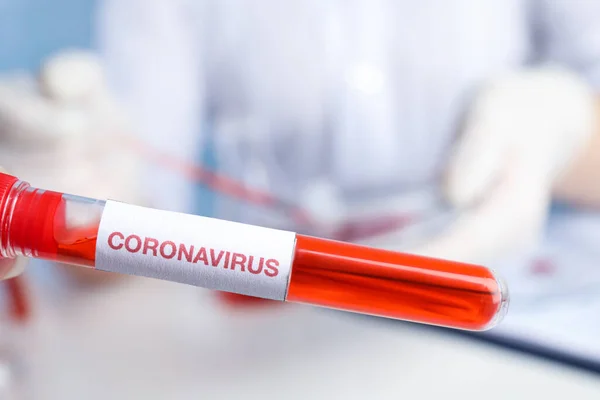 Tubo Ensayo Con Muestra Sangre Etiqueta Virus Corona Laboratorio Primer — Foto de Stock