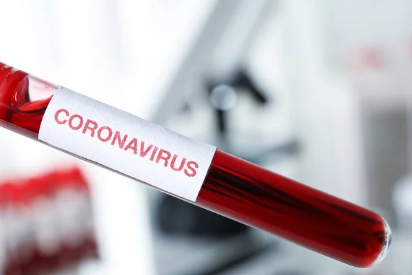 Provetta Con Campione Sangue Etichetta Corona Virus Laboratorio Primo Piano — Foto Stock