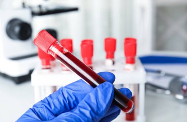 Bilim adamları test tüpünü kan örneğiyle yakın çekimde tutuyor. Virüs araştırması