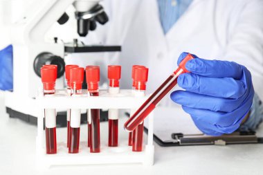 Bilim adamları test tüpünü kan örneğiyle yakın çekimde tutuyor. Virüs araştırması