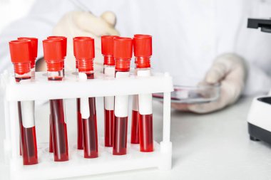Laboratuvarda üzerinde kan örnekleri olan test tüpleri. Virüs araştırması