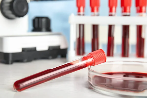Tubo Ensayo Placa Petri Con Muestras Sangre Mesa Laboratorio Primer — Foto de Stock