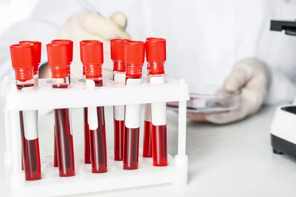 Laboratuvarda Üzerinde Kan Örnekleri Olan Test Tüpleri Virüs Araştırması — Stok fotoğraf