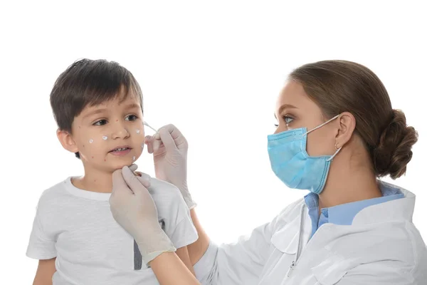 Médico Aplicando Crema Sobre Piel Del Niño Pequeño Con Varicela —  Fotos de Stock