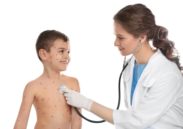 Doctor Examinando Niño Con Varicela Sobre Fondo Blanco Virus Varicela — Foto de Stock