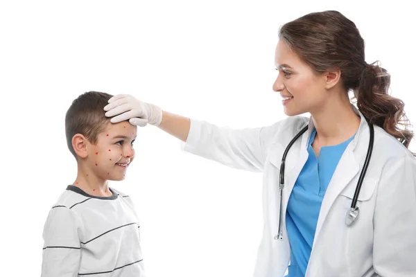 Doutor Examinando Menino Com Varicela Fundo Branco Vírus Varicela Zoster — Fotografia de Stock