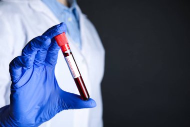 Bilim adamı, üzerinde kan örneği olan test tüpü tutuyor ve siyah arka planda CORONA VIRUS etiketi var, yakın plan. Metin için boşluk