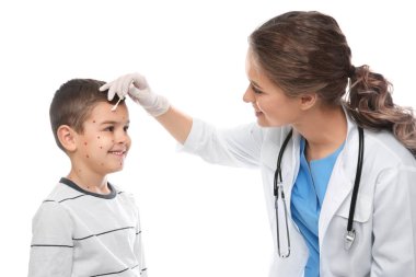 Doktor beyaz arka planda suçiçeği olan küçük bir çocuğun cildine krem sürüyor. Varicella zoster virüsü
