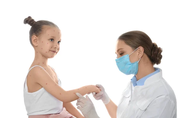 Doctor Examinando Una Niña Con Varicela Sobre Fondo Blanco Virus —  Fotos de Stock