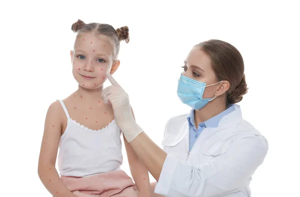 Dottore Esaminando Bambina Con Varicella Sfondo Bianco Virus Della Varicella — Foto Stock