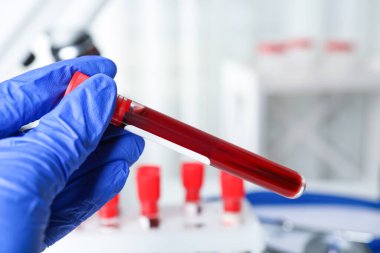Bilim adamları test tüpünü kan örneğiyle yakın çekimde tutuyor. Virüs araştırması