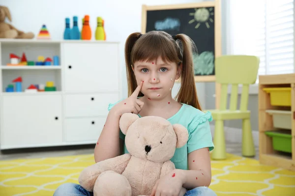 Niña Con Varicela Sosteniendo Oso Peluche Casa —  Fotos de Stock