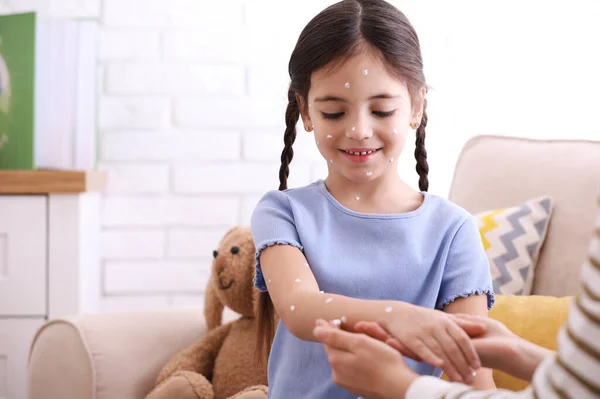 Mãe Aplicando Creme Pele Sua Filha Com Varicela Casa — Fotografia de Stock