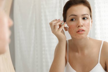 Teen girl with acne problem applying cream near mirror in bathroom clipart