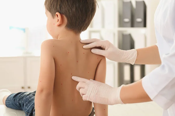 医者は診療所で水痘の少年を診察してます ワリセラゾスターウイルス — ストック写真