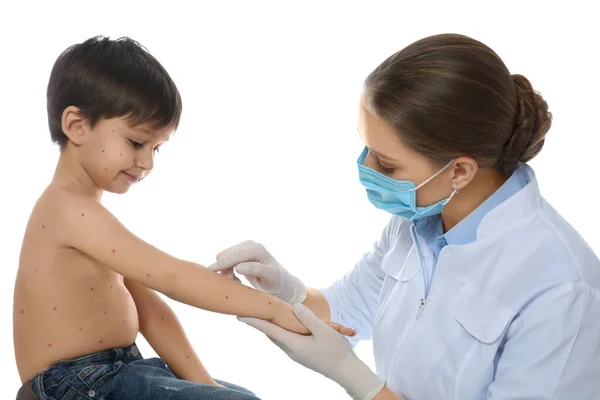 Doctor Examinando Niño Con Varicela Sobre Fondo Blanco Virus Varicela —  Fotos de Stock
