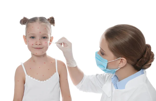 Lekarz Nakładający Krem Skórę Dziewczynki Ospą Wietrzną Białym Tle Wirus — Zdjęcie stockowe