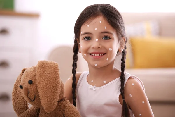 Niña Con Varicela Jugando Casa —  Fotos de Stock