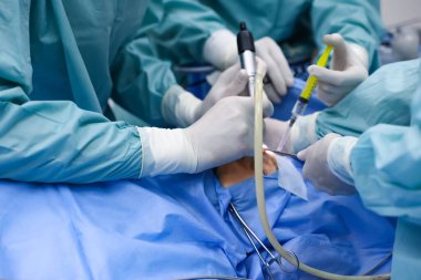 Profesyonel doktorlardan oluşan bir ekip ameliyathanede ameliyat yapıyor.
