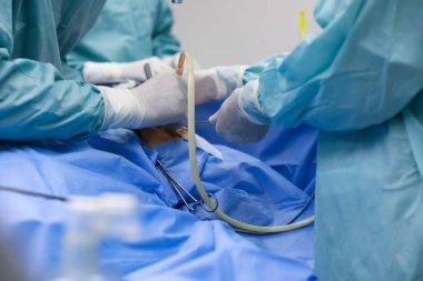 Profesyonel doktorlardan oluşan bir ekip ameliyathanede ameliyat yapıyor.