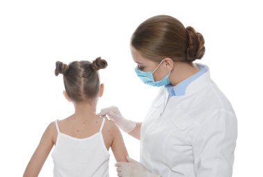 Doktor beyaz arka planda suçiçeği olan küçük bir kızı muayene ediyor. Varicella zoster virüsü
