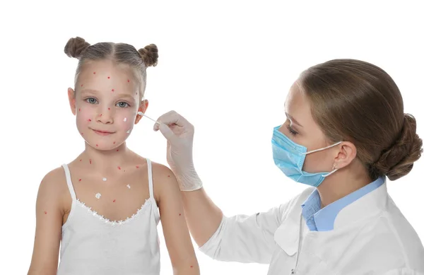 Doctor Applying Cream Skin Little Girl Chickenpox White Background Varicella — Stock Photo, Image